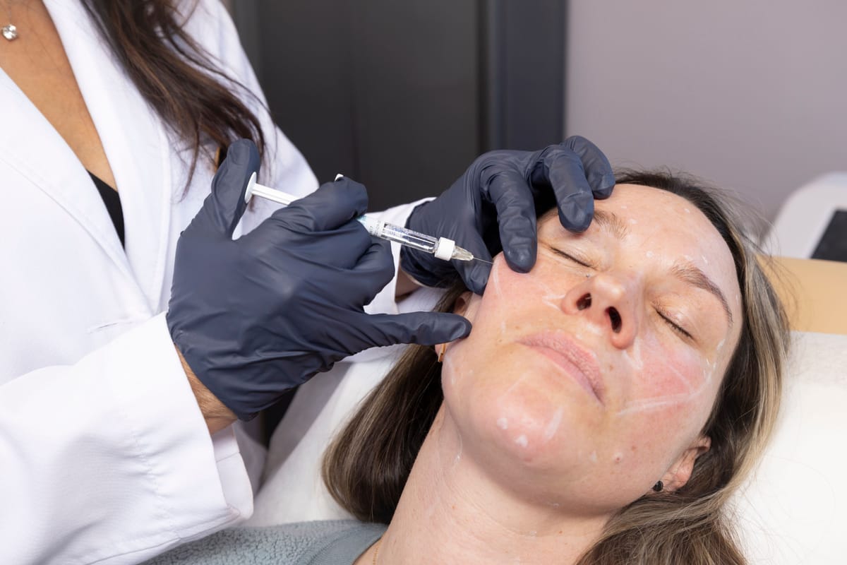 Dr. Macha performing a mapped dermal filler treatment