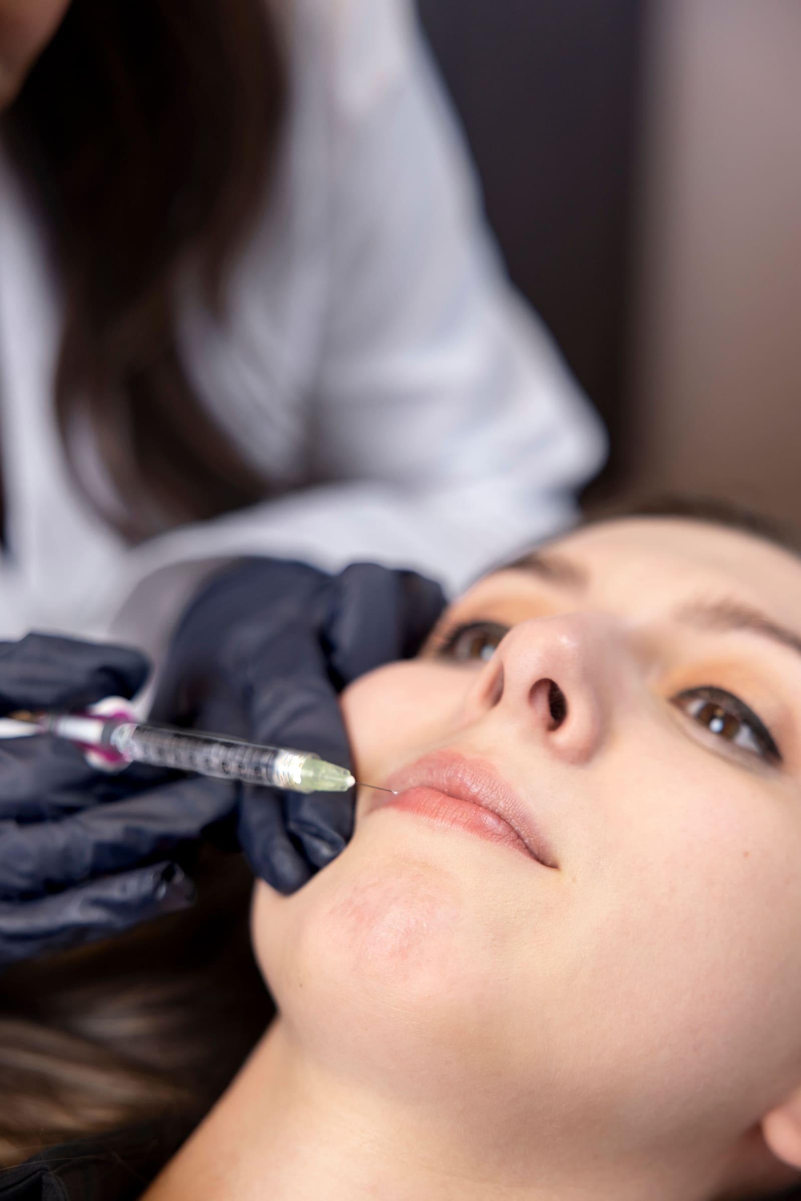 Lip filler treatment in progress at CosMedic LaserMD